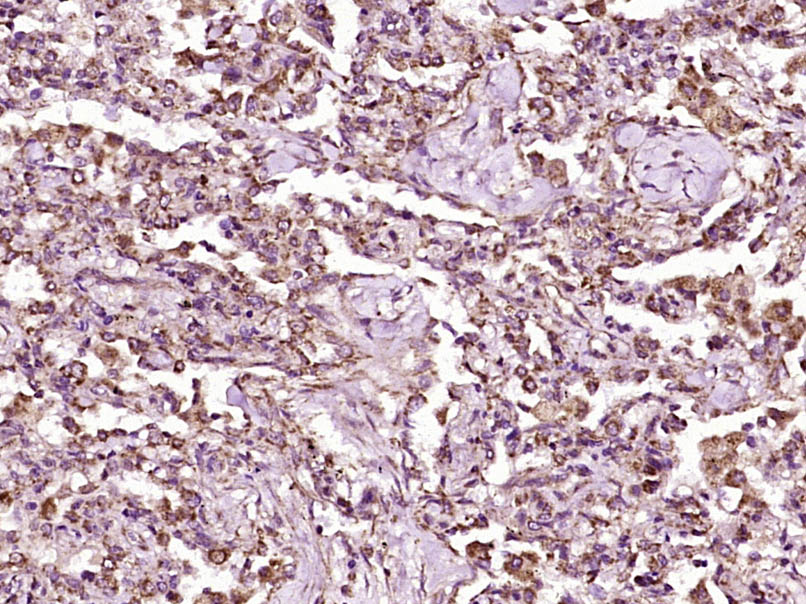 14 - RASSF3 Rabbit pAb AP58371