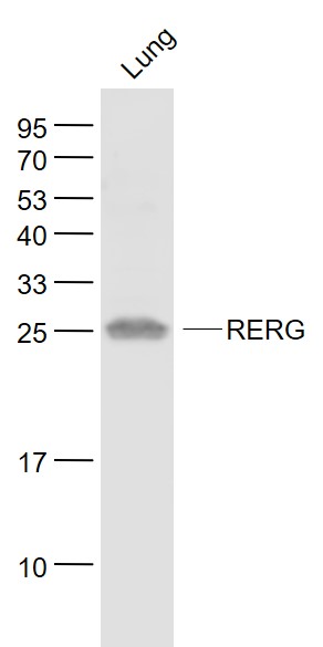 1 - RERG Rabbit pAb AP58373