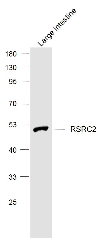 1 - RSRC2 Rabbit pAb AP58375