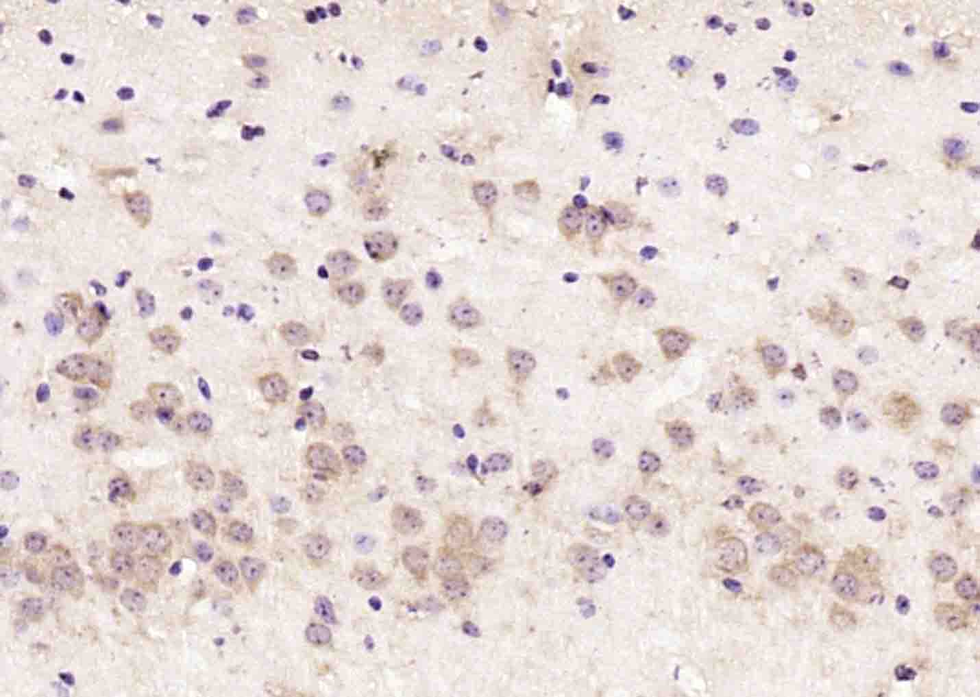 14 - RSRC2 Rabbit pAb AP58375