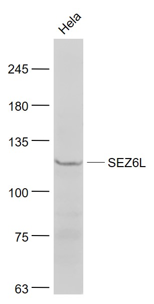 1 - SEZ6L Rabbit pAb AP58377