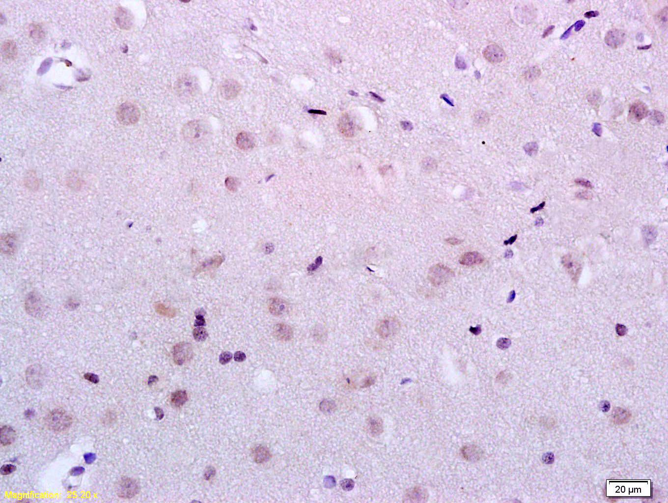 14 - KDM5B Rabbit pAb AP58384