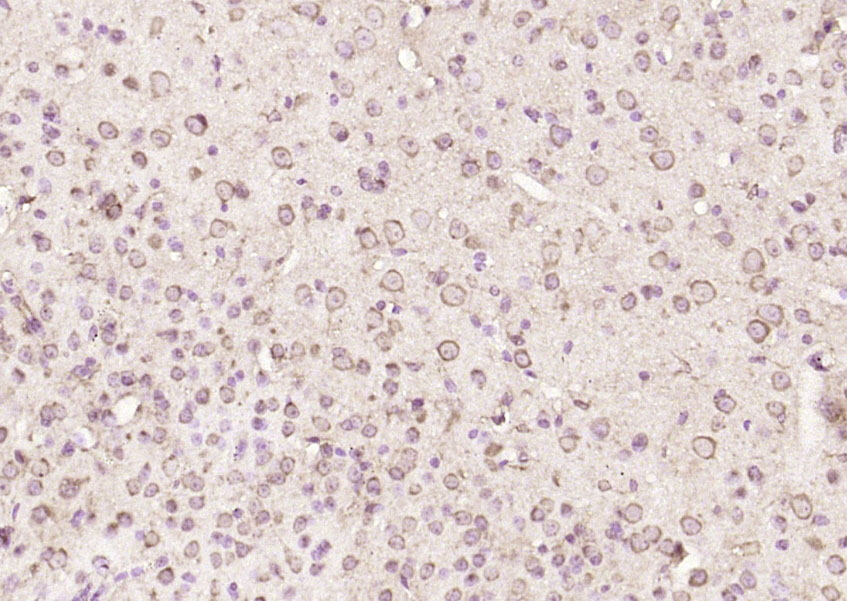 14 - TP53I13 Rabbit pAb AP58385