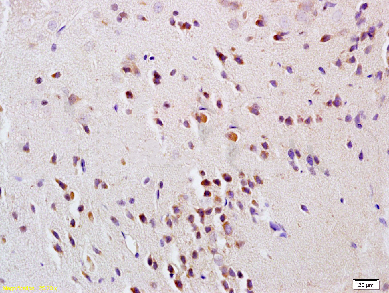 14 - GNAT3 Rabbit pAb AP58386