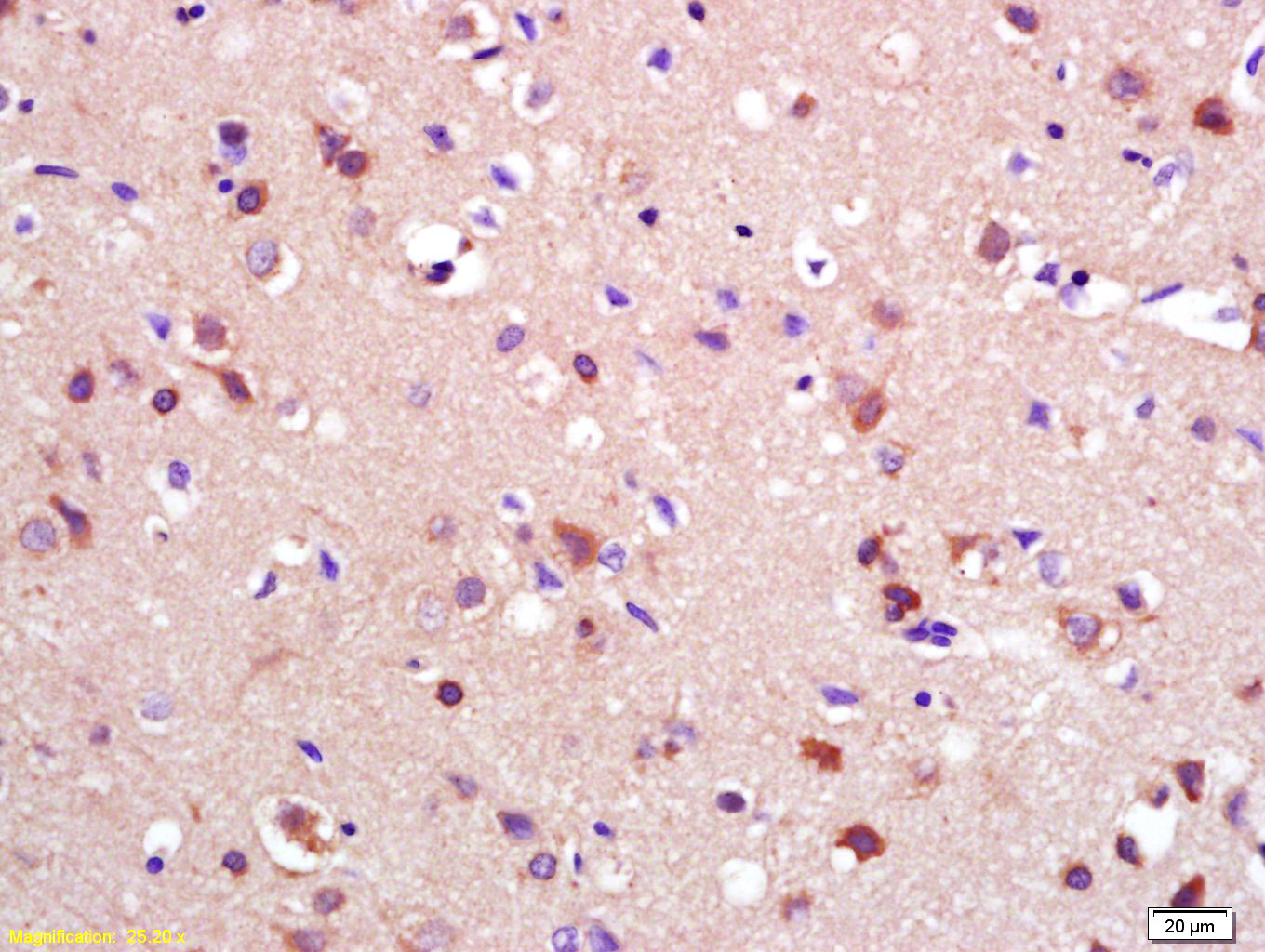 14 - RASGEF1A Rabbit pAb AP58387