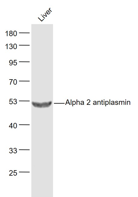 1 - Alpha 2 antiplasmin Rabbit pAb AP58392