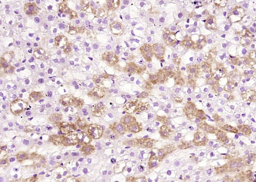 14 - Alpha 2 antiplasmin Rabbit pAb AP58392