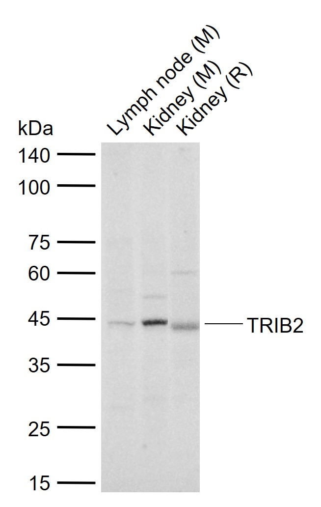 1 - TRIB2 Rabbit pAb AP58406