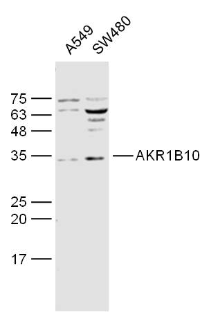 1 - AKR1B10 Rabbit pAb AP58407