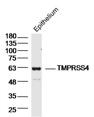 1 - TMPRSS4 Rabbit pAb AP58410