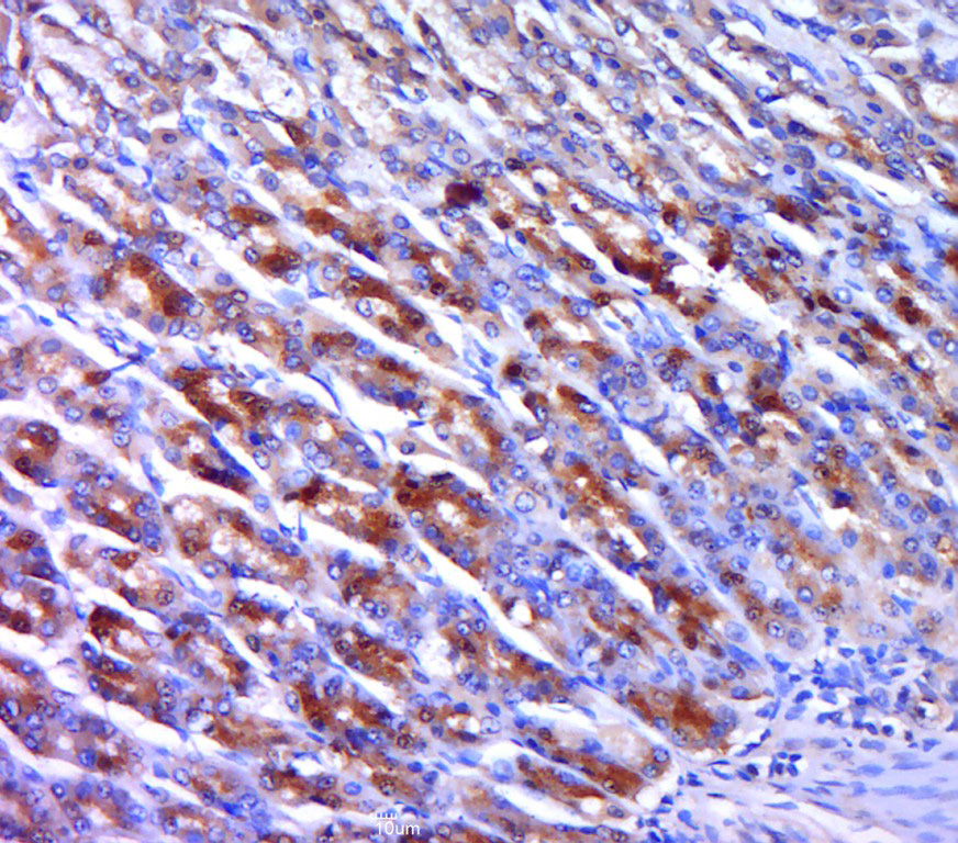 14 - UEVLD Rabbit pAb AP58411