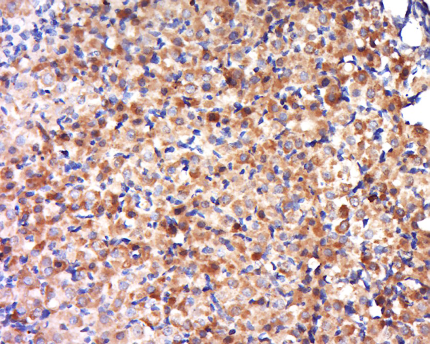 14 - OVCA2 Rabbit pAb AP58414