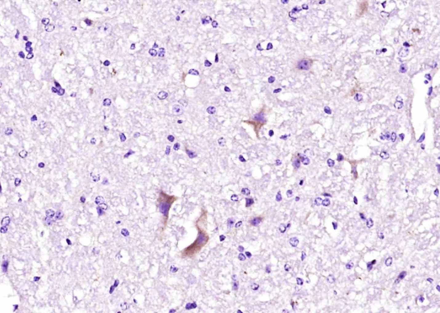 14 - Ryanodine Receptor Rabbit pAb AP58415
