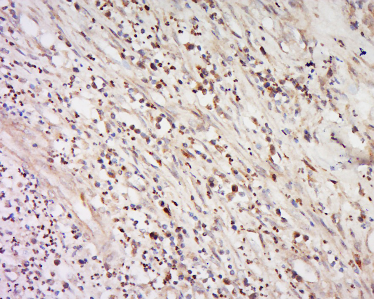 14 - IFNA16/Interferon alpha 16 Rabbit pAb AP58419