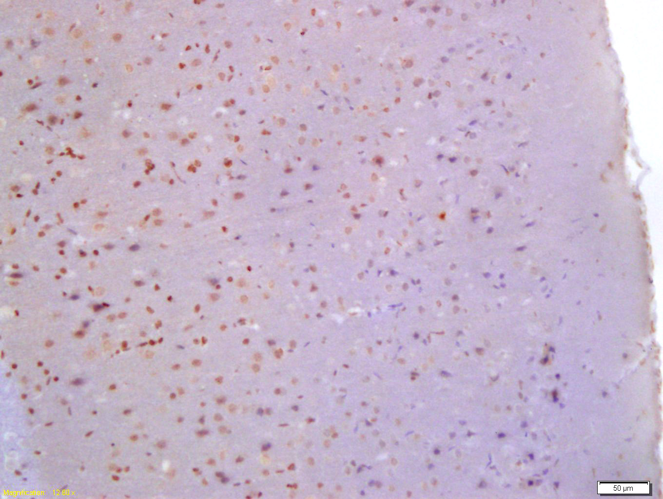 14 - Glutamine PRPP amidotransferase Rabbit pAb AP58423