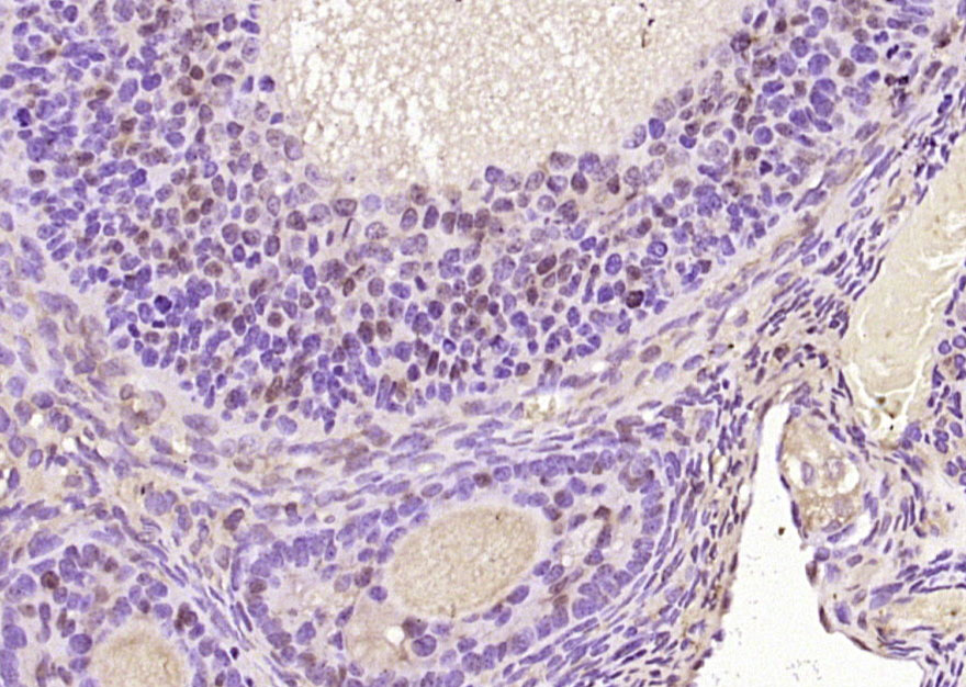 14 - FAM107A Rabbit pAb AP58428