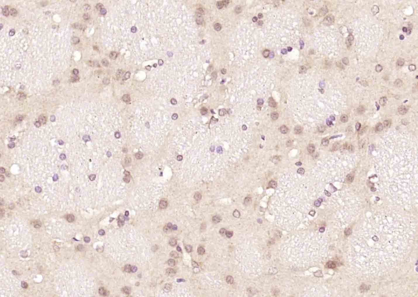 14 - PCNP Rabbit pAb AP58434