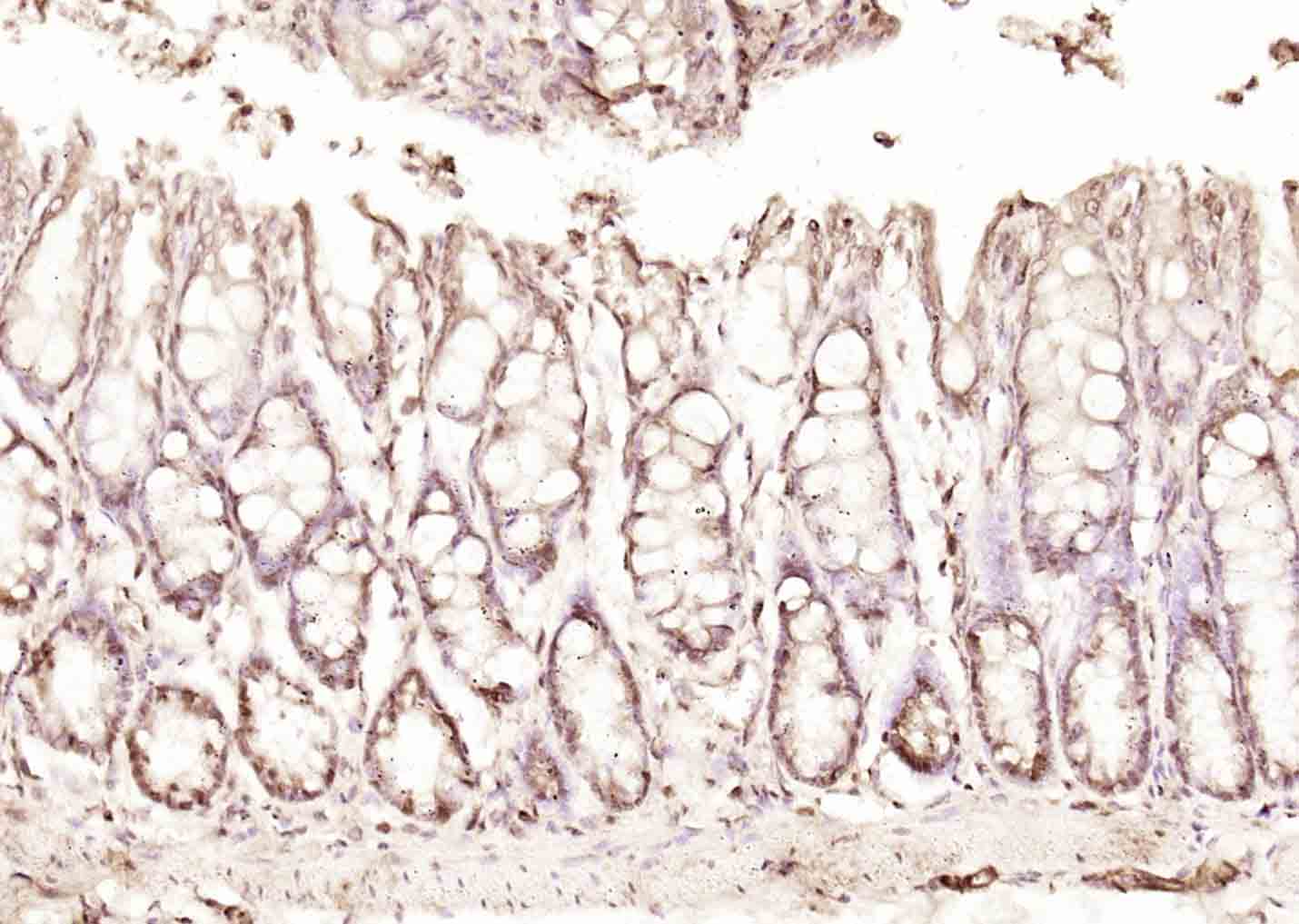14 - CLLD8 Rabbit pAb AP58441