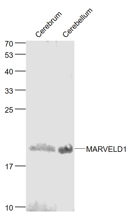 1 - MARVELD1 Rabbit pAb AP58467