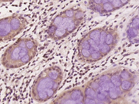 14 - PAGE1 Rabbit pAb AP58469