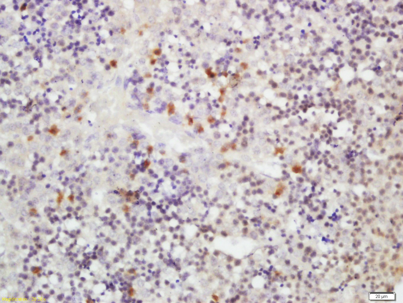 14 - RLBP1L1 Rabbit pAb AP58472