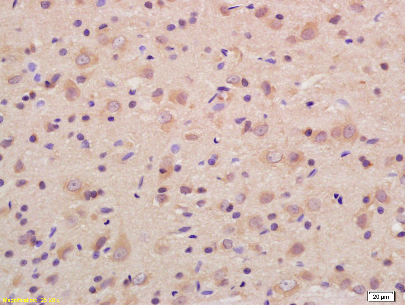 14 - SCN11A Rabbit pAb AP58486