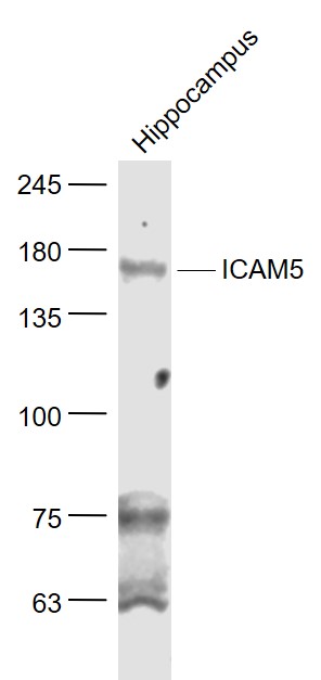 1 - ICAM5 Rabbit pAb AP58488