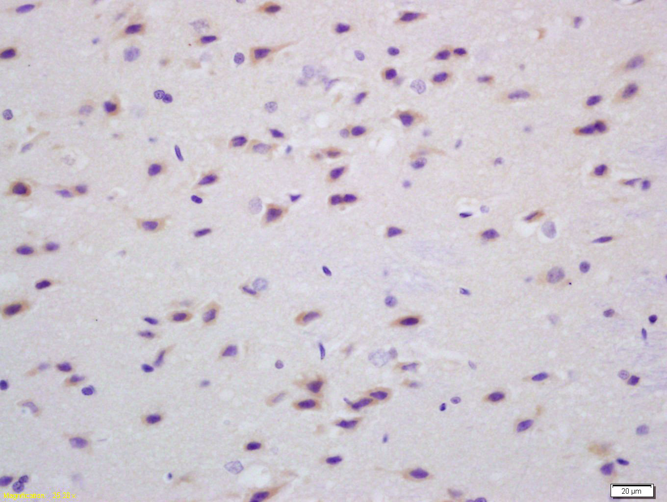 14 - Transglutaminase-1 Rabbit pAb AP58491