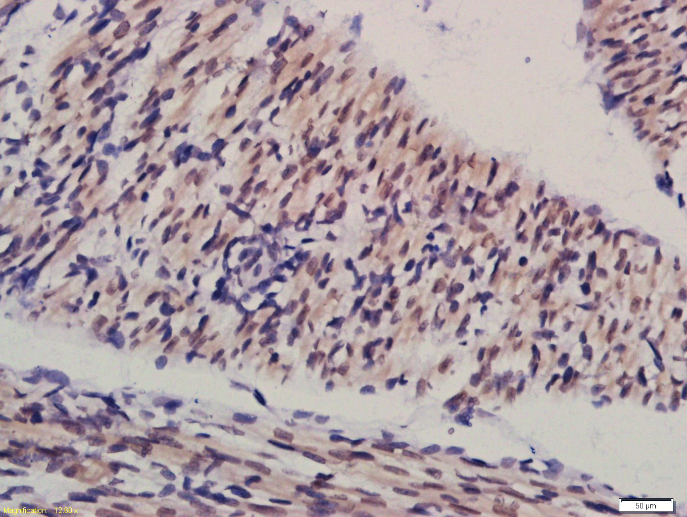 14 - Sertad1 Rabbit pAb AP58492