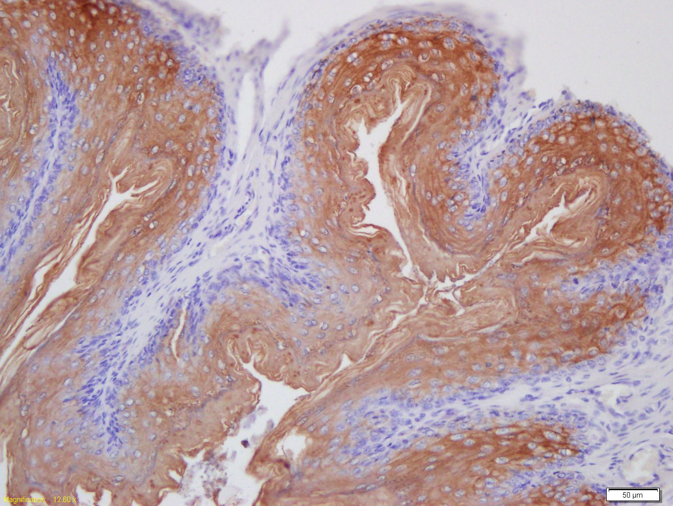 14 - Laminin 5 Rabbit pAb AP58496