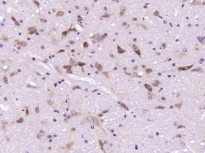 14 - Uricase Rabbit pAb AP58497