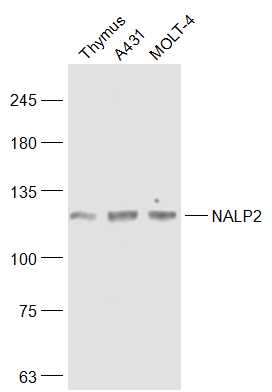 1 - NALP2 Rabbit pAb AP58498