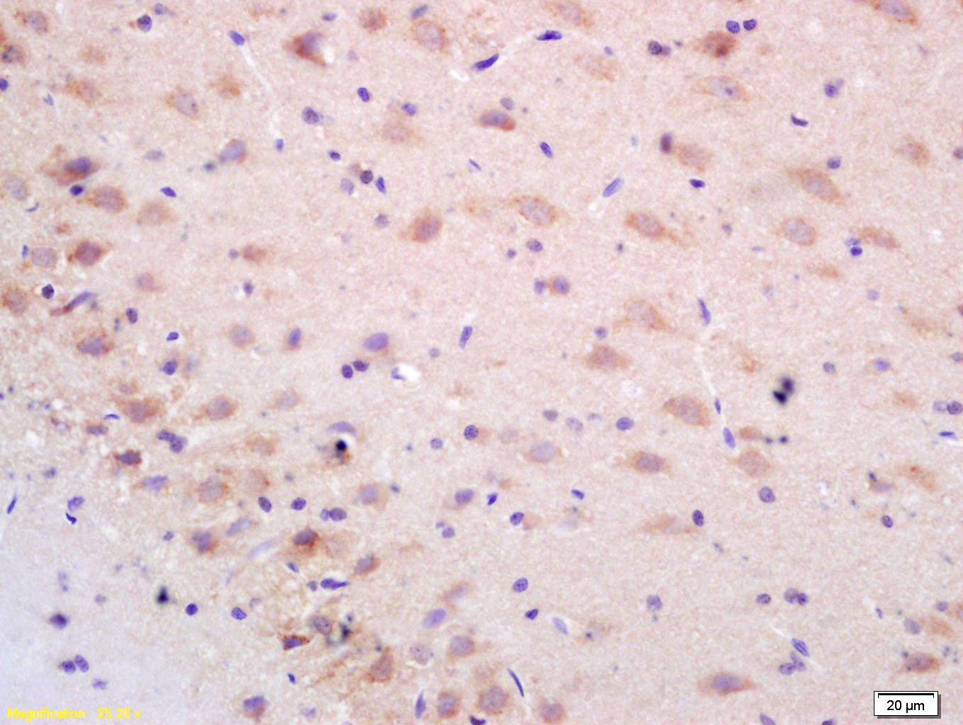 14 - NALP2 Rabbit pAb AP58498