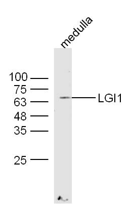 1 - LGI1 Rabbit pAb AP58499