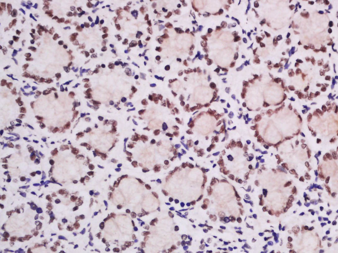 14 - Ubiquitously expressed transcript Rabbit pAb AP58504