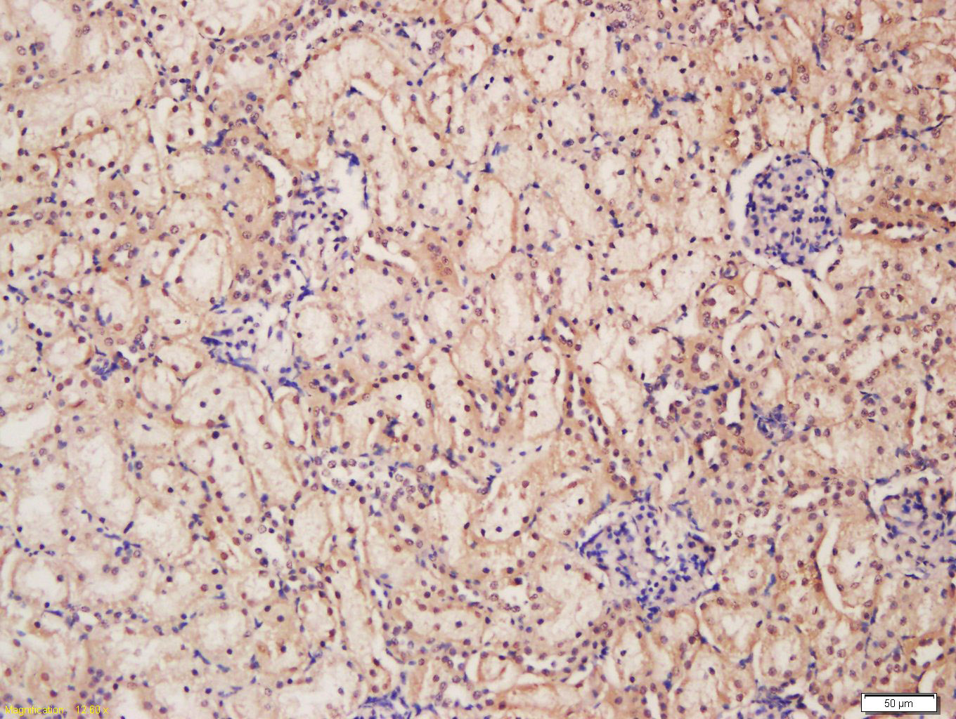 14 - WWP1 Rabbit pAb AP58505