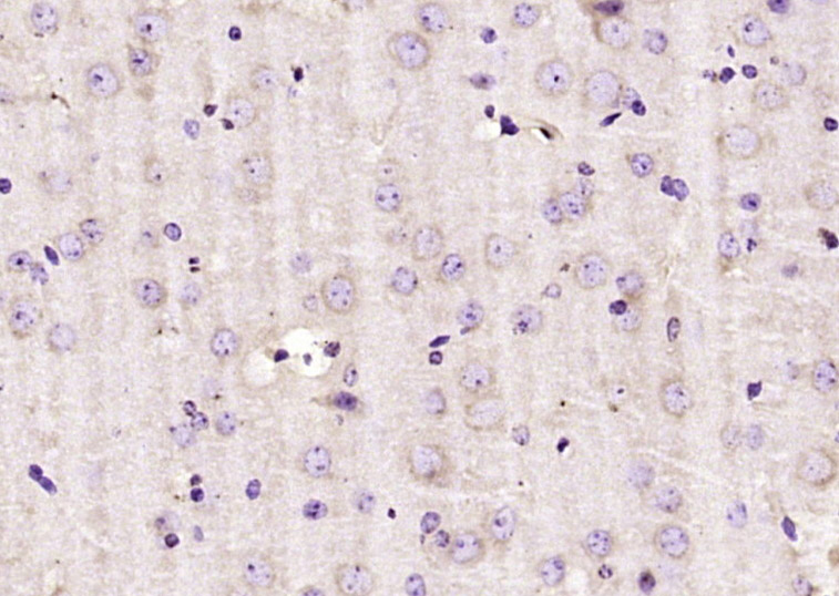 14 - DAD1 Rabbit pAb AP58513