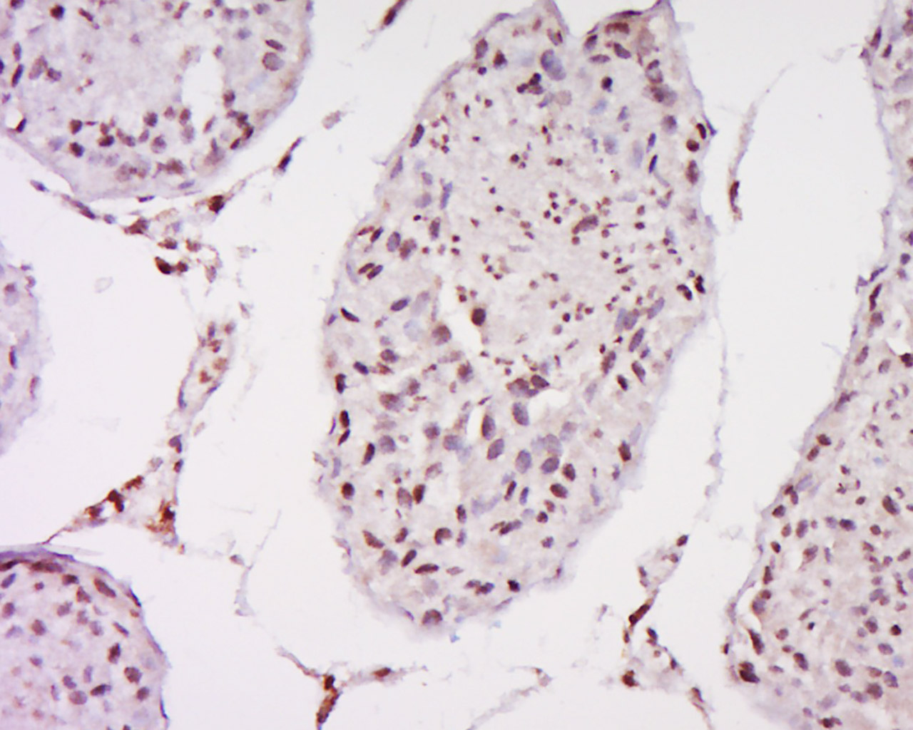 14 - MAGEB1 Rabbit pAb AP58520