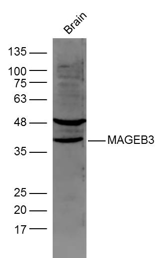 1 - MAGEB3 Rabbit pAb AP58521