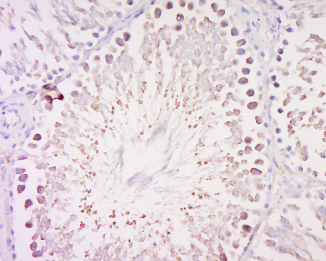 14 - MAGEB3 Rabbit pAb AP58521
