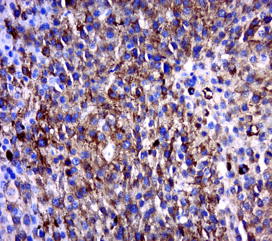 14 - MAGEB6 Rabbit pAb AP58523