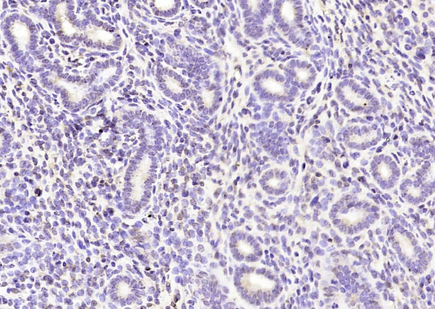 14 - IFRD1 Rabbit pAb AP58541