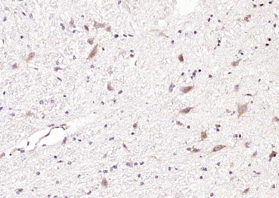 14 - CCDC50 Rabbit pAb AP58550