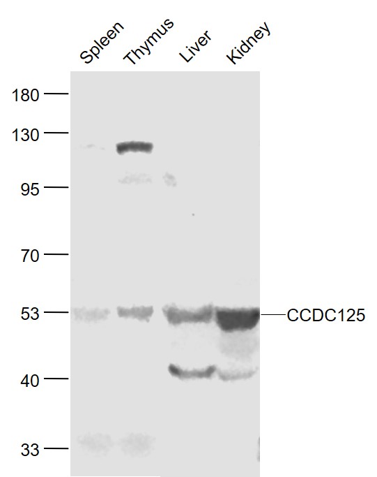 1 - CCDC125 Rabbit pAb AP58553