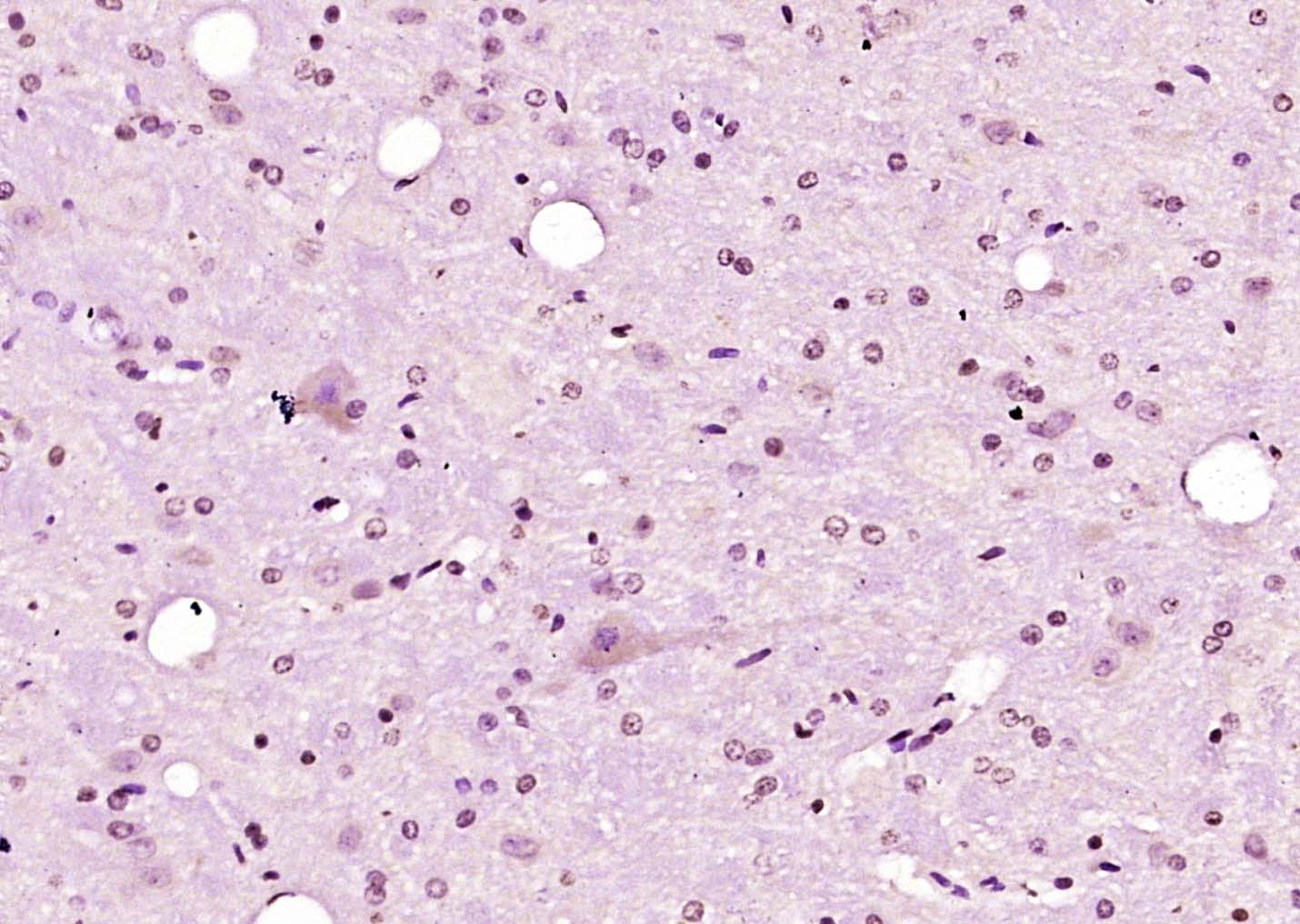 14 - CCDC17 Rabbit pAb AP58554