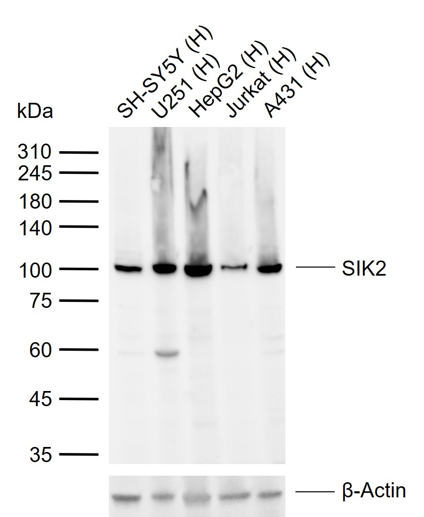 1 - SIK2 Rabbit pAb AP58555