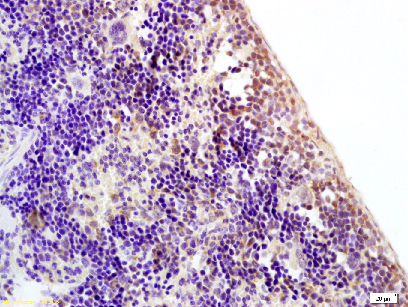 14 - ZNF521 Rabbit pAb AP58562