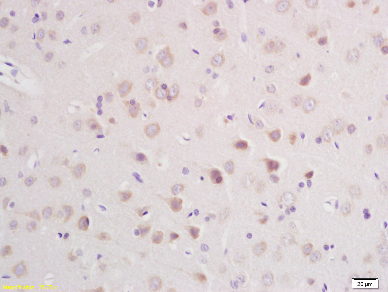 14 - CLCN3 Rabbit pAb AP58563