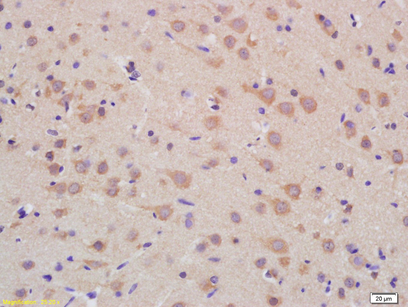 14 - PMPCB Rabbit pAb AP58568