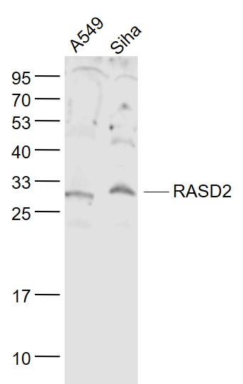 1 - RASD2 Rabbit pAb AP58569
